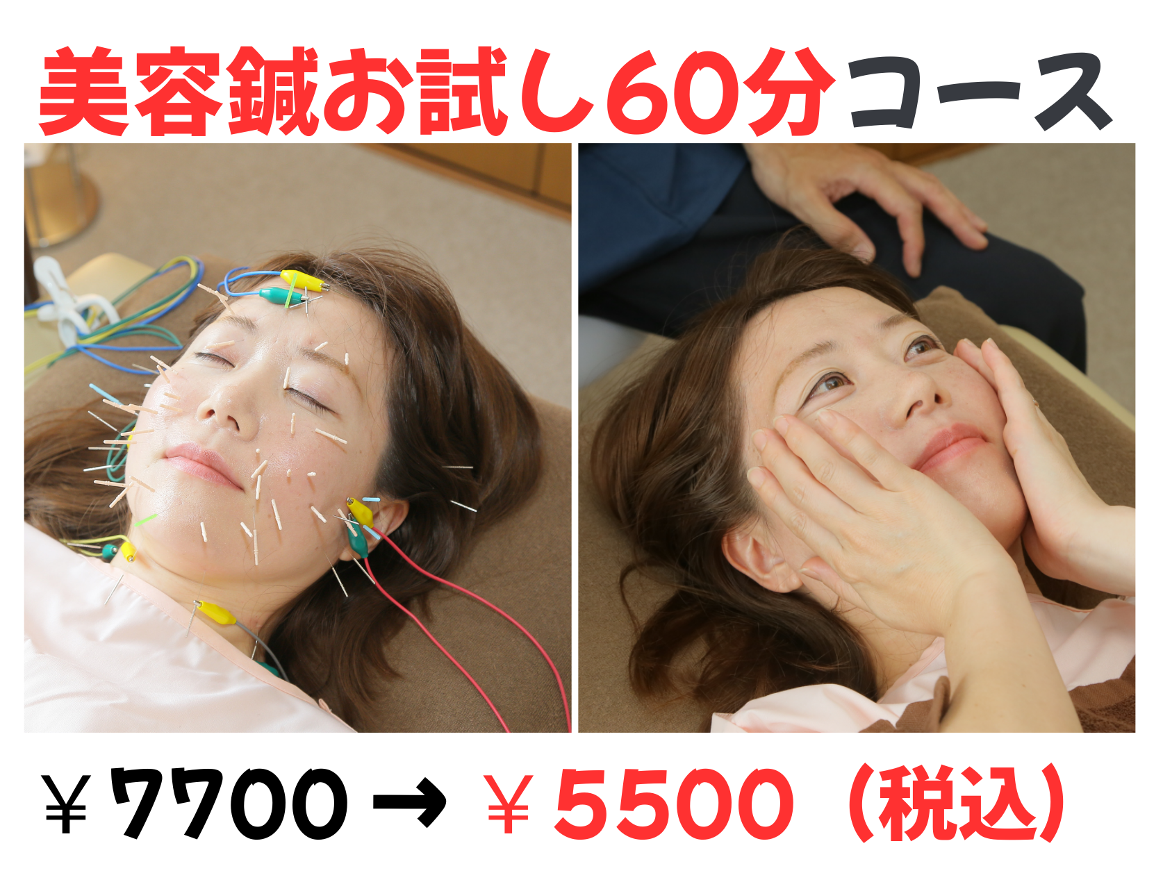 みずのえ鍼灸院 美容鍼60分初回おためしコース（EMS通電パルス鍼付）＋カウンセリング付（20分）のメニュー画像