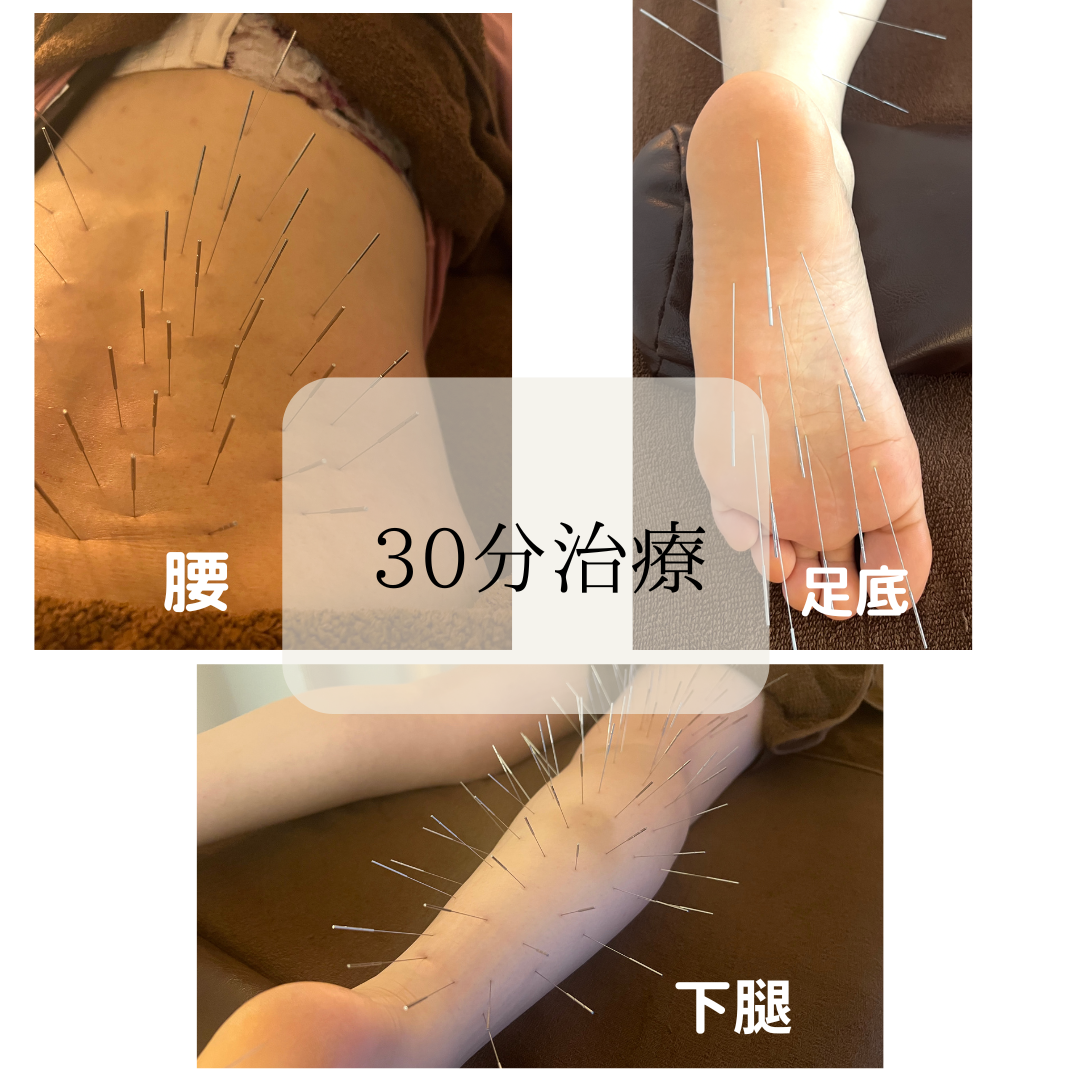 けんたろう鍼灸院 ルート鍼治療　30分のメニュー画像