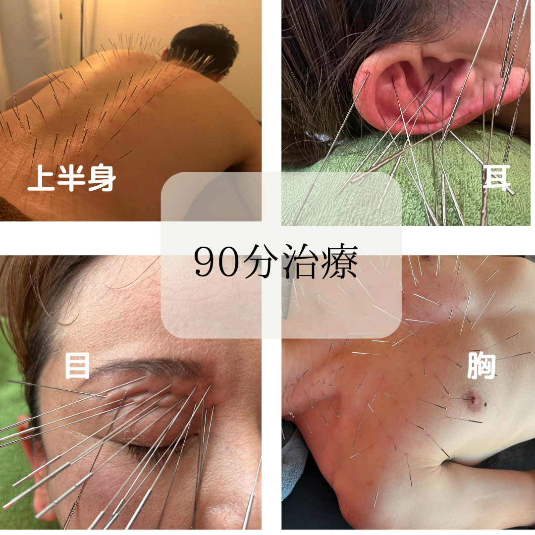 けんたろう鍼灸院 ルート鍼治療　90分のメニュー画像