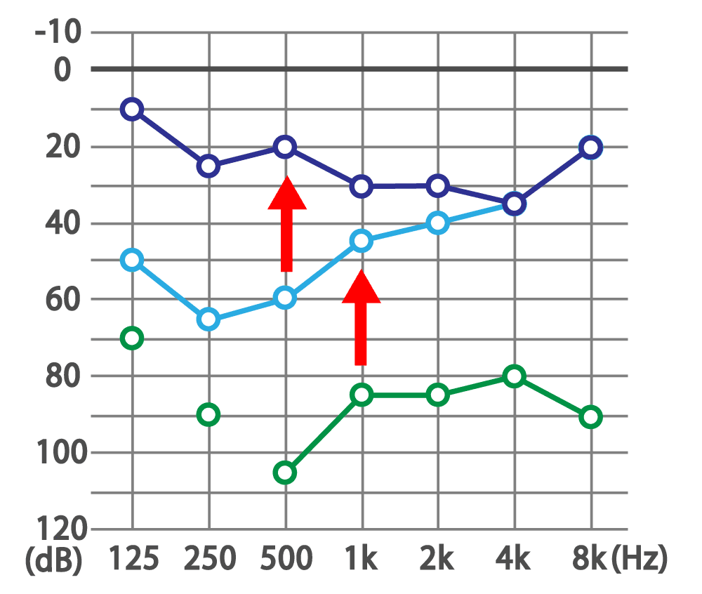 難聴・不妊症・頭痛・起立性調節障害 専門鍼灸院　剛鍼灸治療院 難聴は１日でも早い治療が大切！のメニュー画像