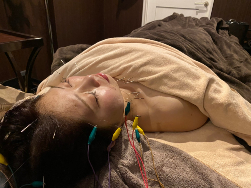 ハリスパ堀江院 リフトアップ美容鍼集中コース【通電美容鍼と頭皮鍼】のメニュー画像