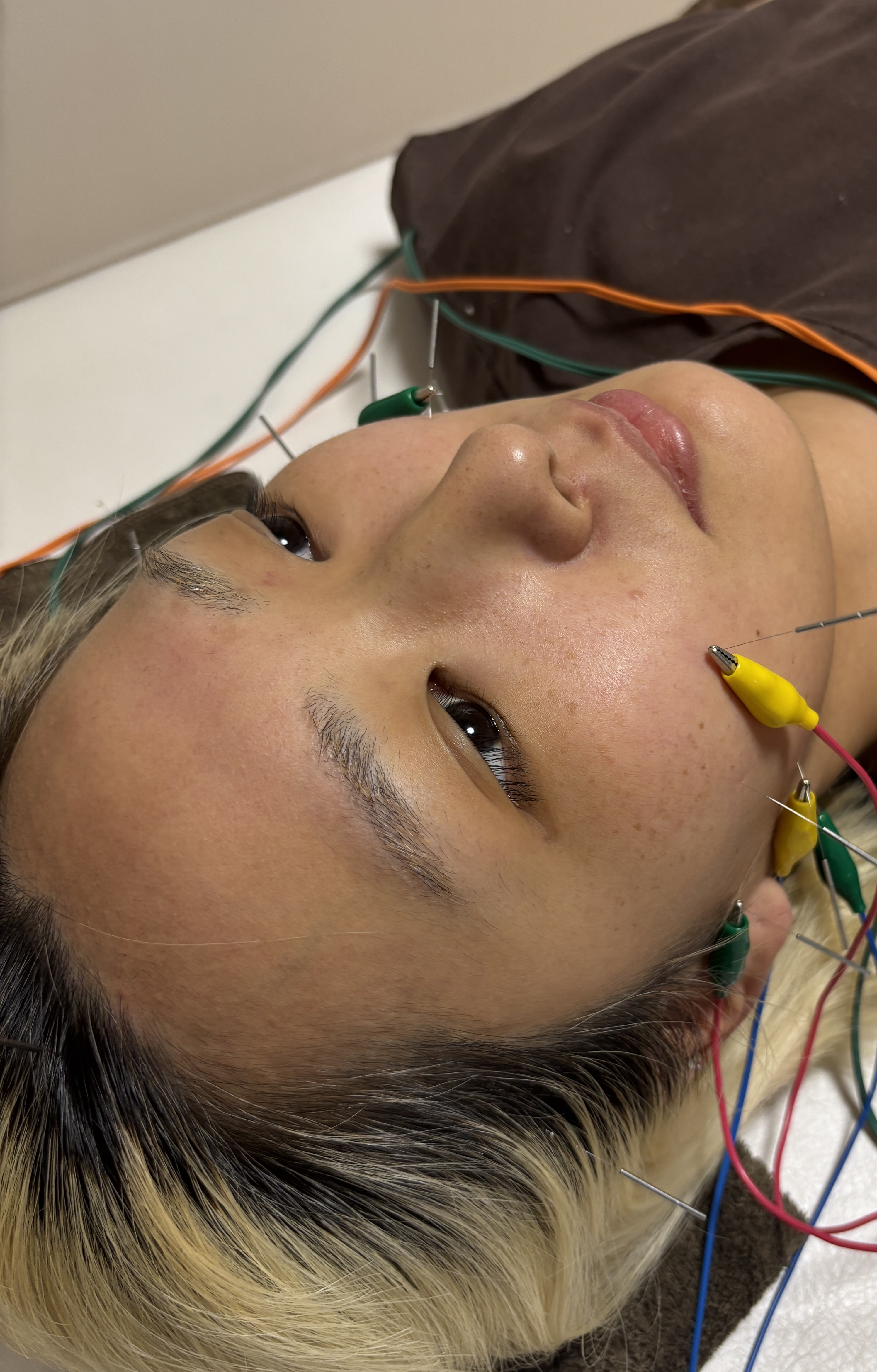 maryu358鍼灸・整体院 美容鍼のメニュー画像