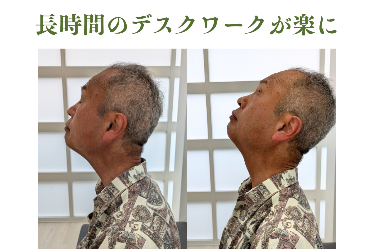 【美容鍼・育毛鍼】はりきゅうeFu-エフ- 【2回目以降】首・肩・背中の治療のメニュー画像