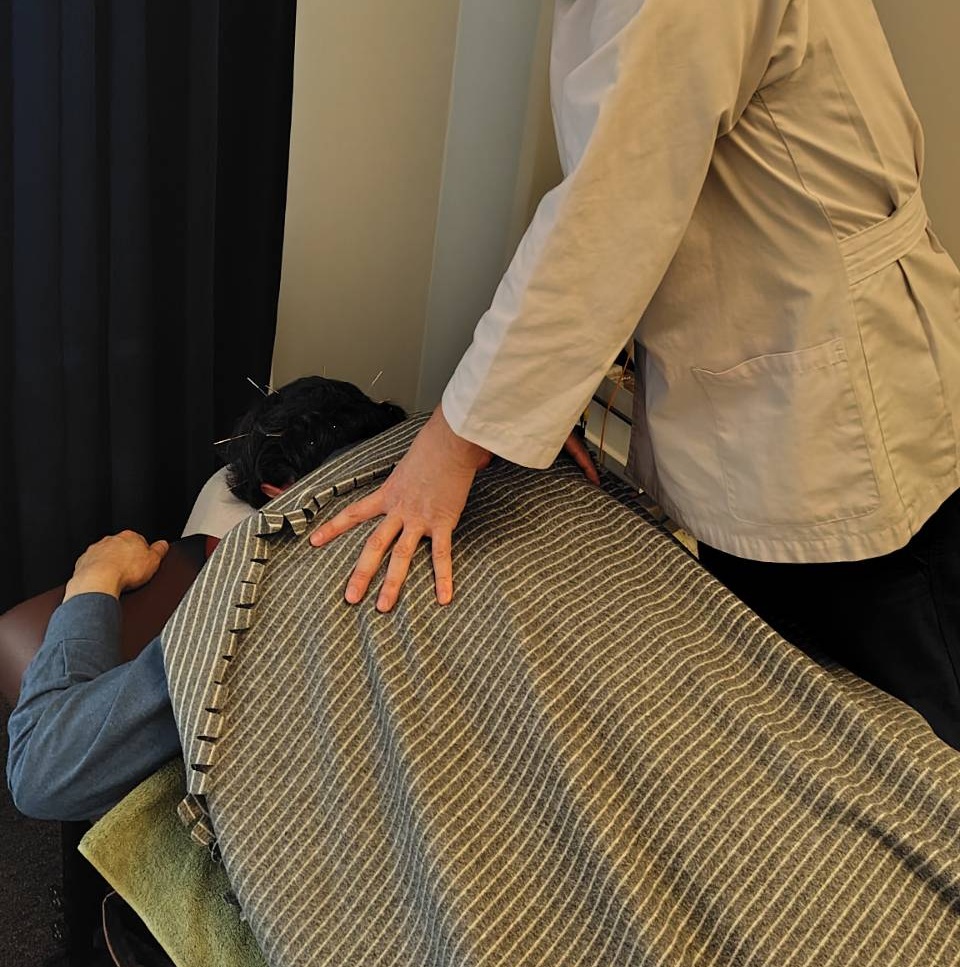 やすだ鍼灸室 【初めての方・迷ったらこちら】全身おまかせ鍼灸（60分）【初回 5,000円】のメニュー画像