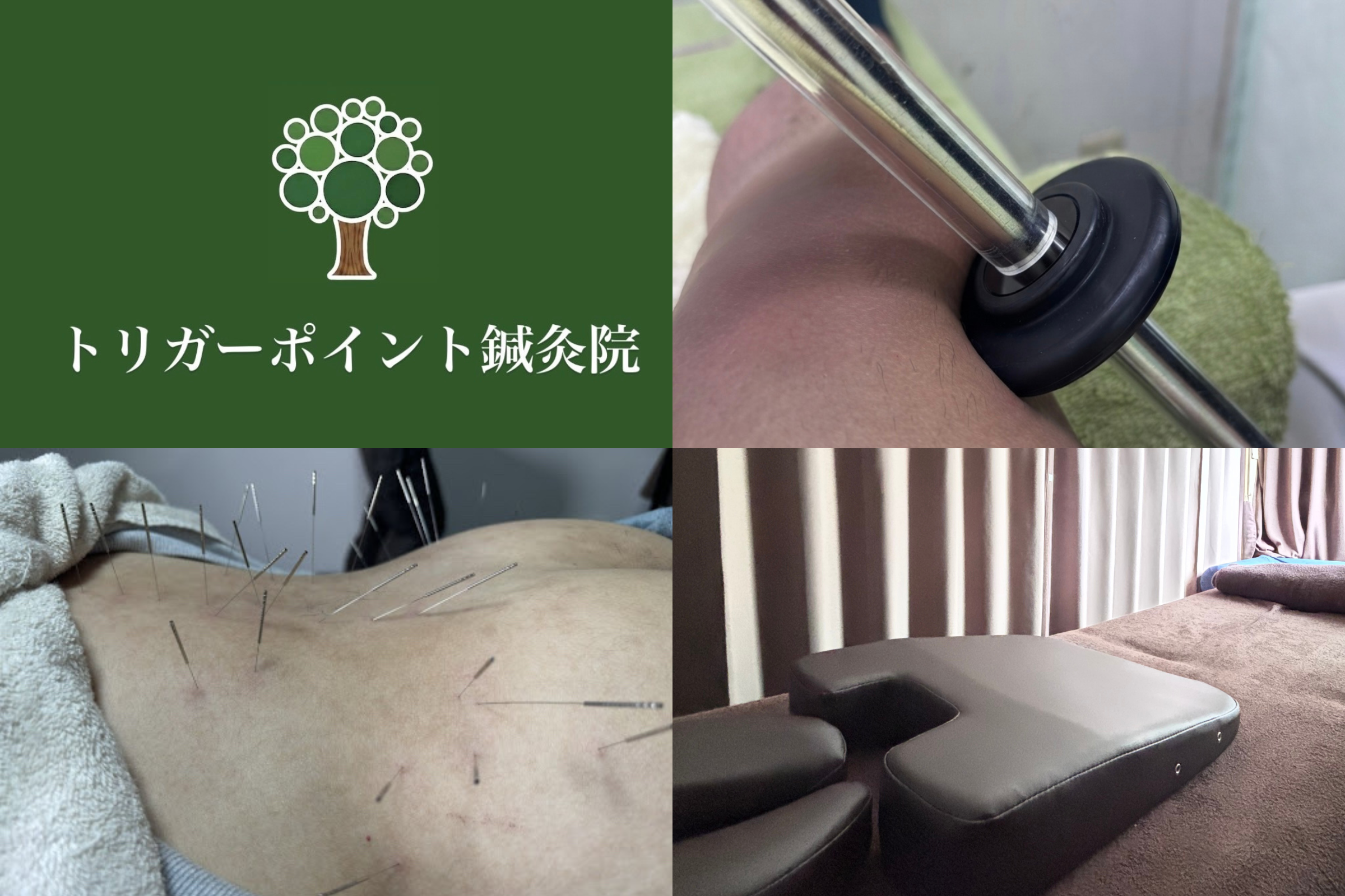 トリガーポイント鍼灸院 院詳細 | 堺・泉南の鍼灸院・美容鍼サロン