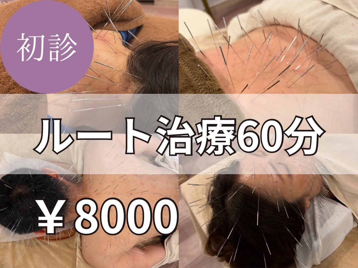 tubomi -美、癒し処- 【ご新規様限定】オーダーメイド☆ルート鍼60分　20000円→8000円のメニュー画像
