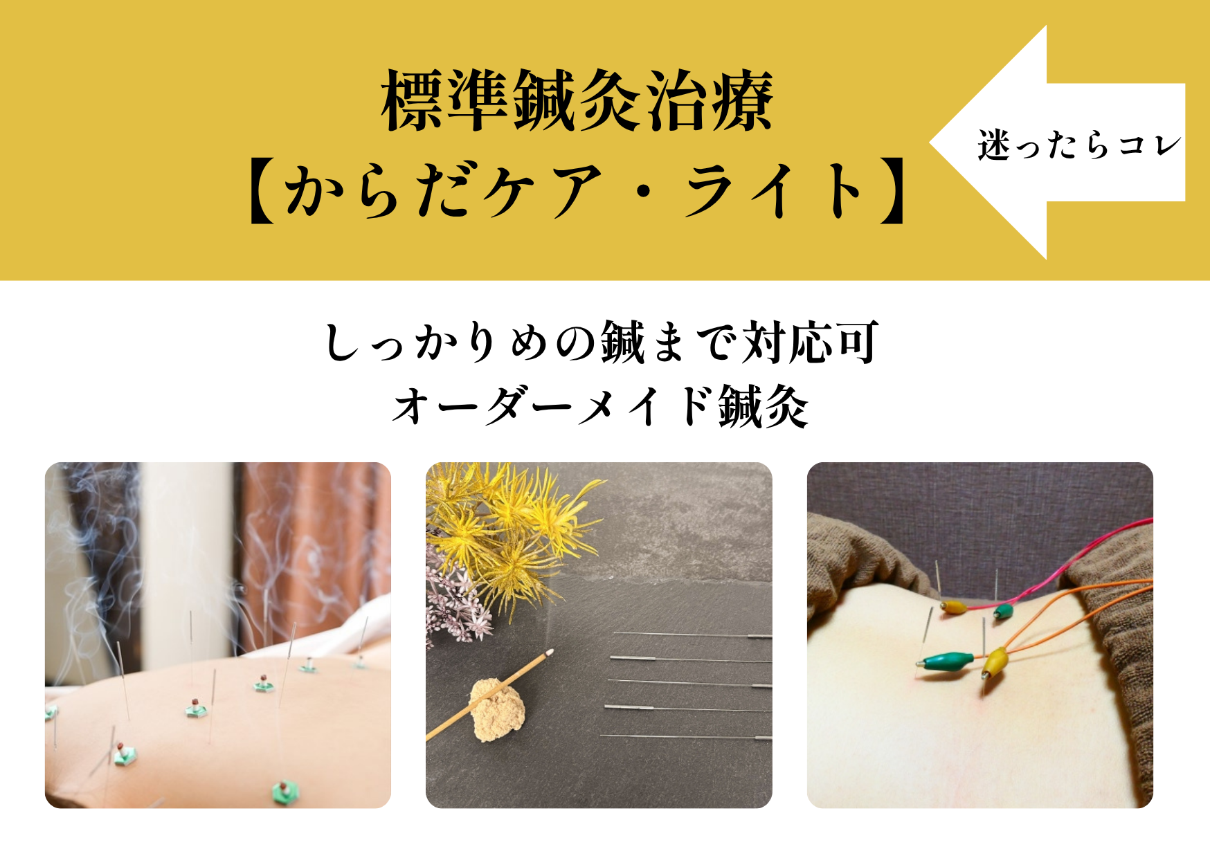 ゆり鍼灸院 標準鍼灸【からだケア・ライト】　　※迷ったらコレのメニュー画像