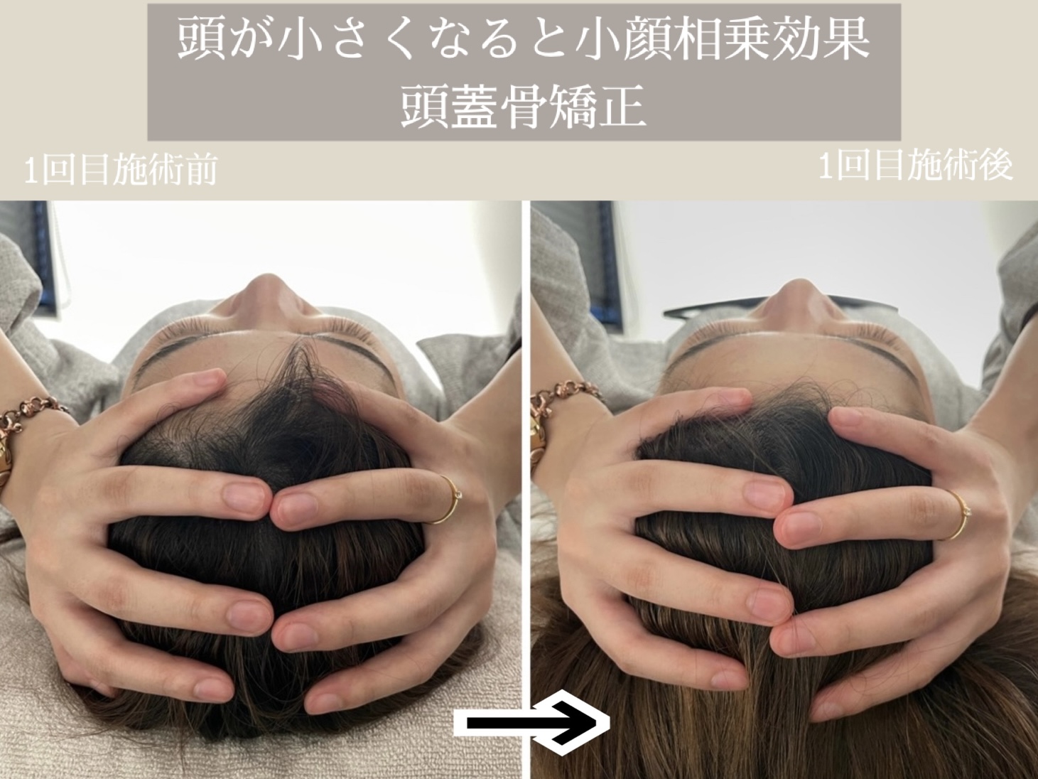 小顔矯正・美容鍼灸salon Yusaku 院詳細 | 本町・船場の鍼灸院・美容鍼