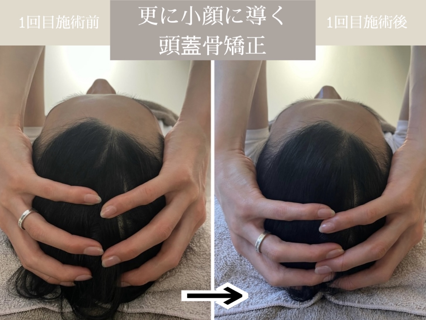 小顔矯正・美容鍼灸salon Yusaku 院詳細 | 本町・船場の鍼灸院・美容鍼