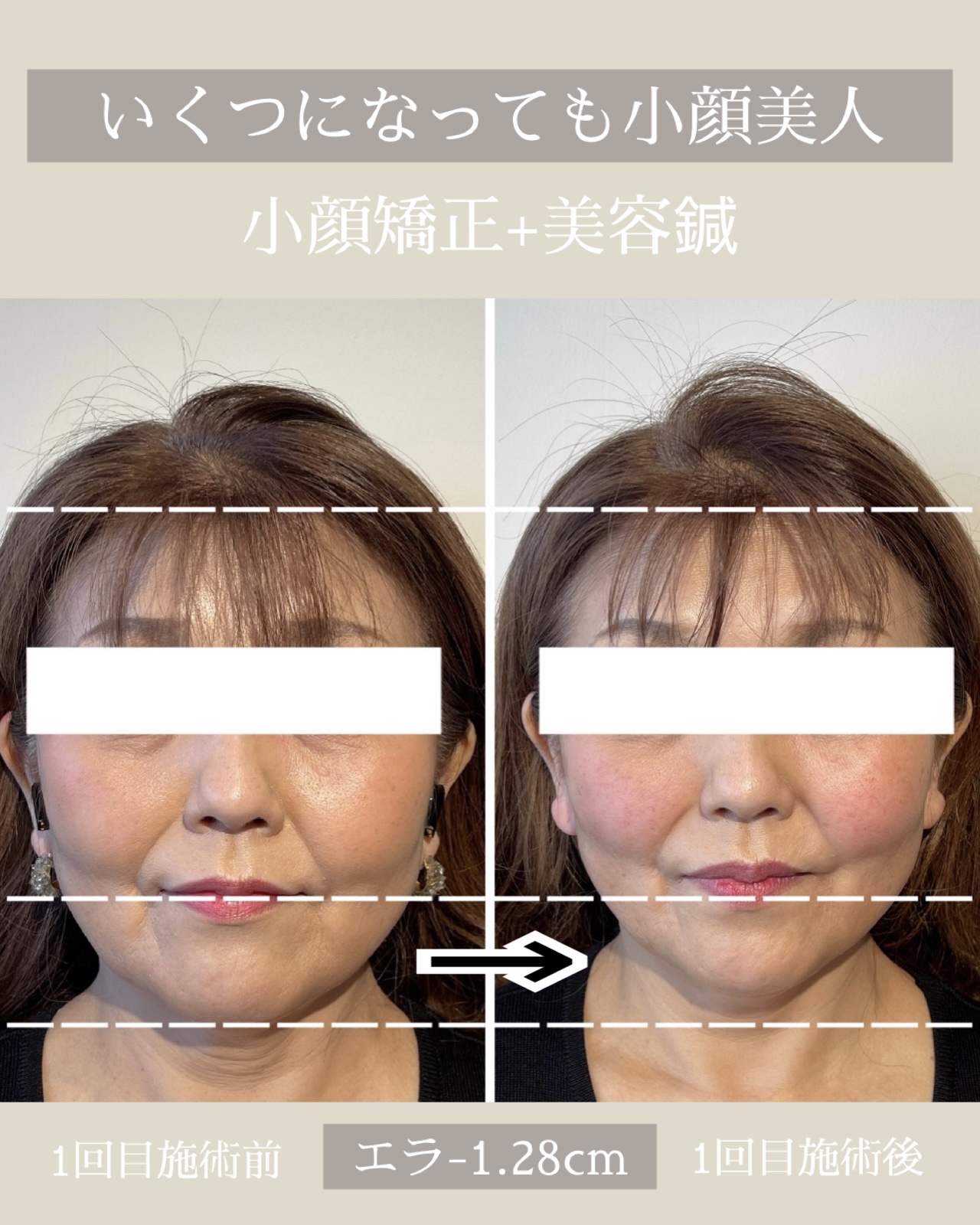 小顔矯正・美容鍼灸salon Yusaku 院詳細 | 本町・船場の鍼灸院・美容鍼